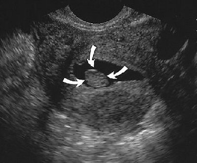 2004 10 29 17 13 53 706