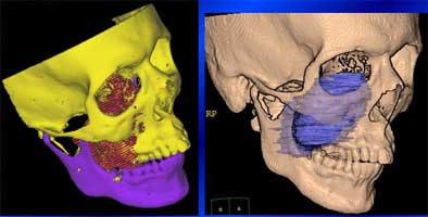 2004 11 15 17 42 33 706