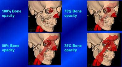 2004 11 15 17 42 48 706