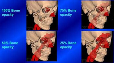 2004 11 15 17 42 48 706