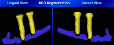 2004 11 15 17 43 06 706