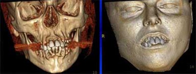 2004 11 15 17 43 47 706