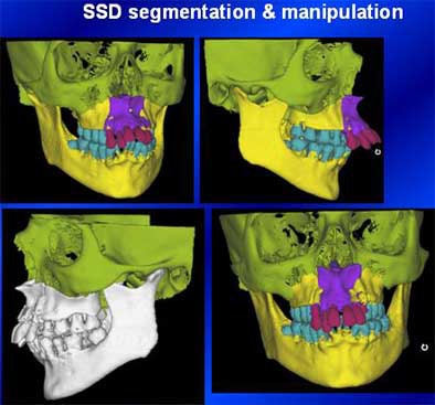2004 11 15 17 45 17 706