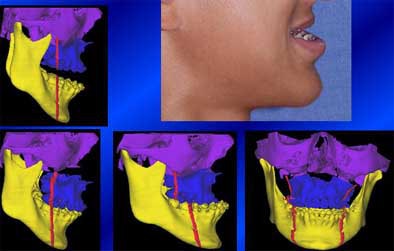 2004 11 15 18 28 36 706