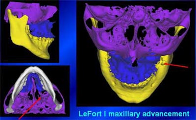 2004 11 15 18 28 55 706