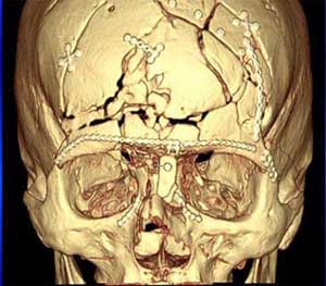 2004 11 15 18 37 54 706