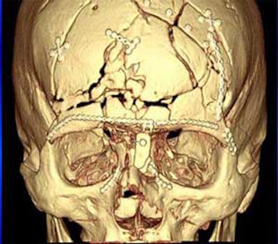 2004 11 15 18 37 54 706