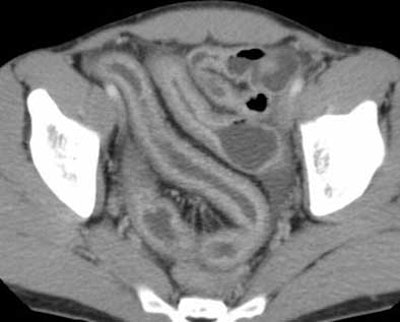 2004 11 17 17 53 59 706