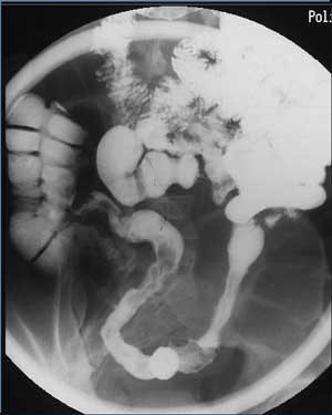 2004 11 17 17 55 01 706