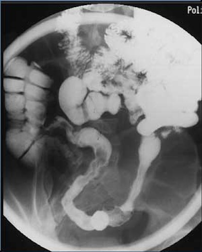 2004 11 17 17 55 01 706