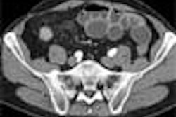 2004 11 17 17 55 31 706