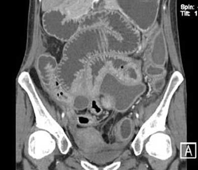 2004 11 17 18 10 32 706