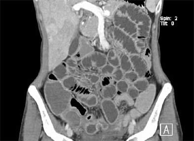 2004 11 17 18 11 26 706