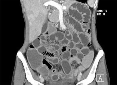 2004 11 17 18 11 26 706