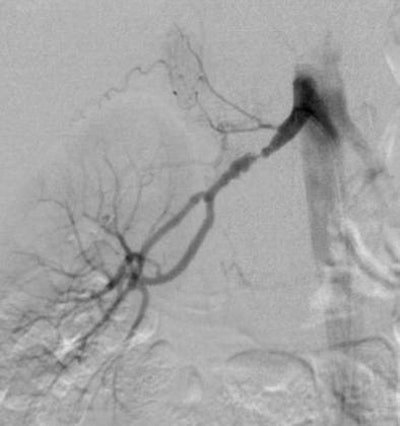 2004 11 18 13 12 40 706