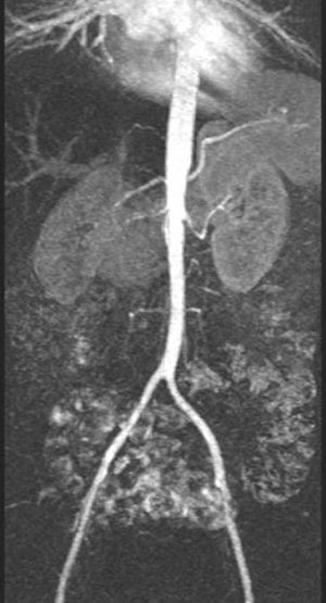 2004 11 18 13 20 04 706