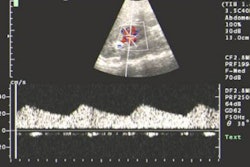 2004 11 18 13 28 35 706