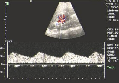 2004 11 18 13 28 35 706