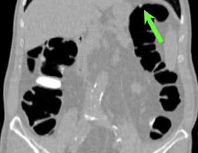 2004 11 22 15 43 32 706