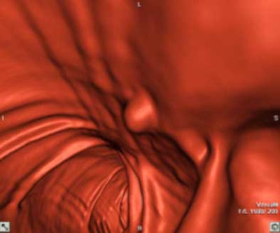 2004 11 22 15 44 26 706