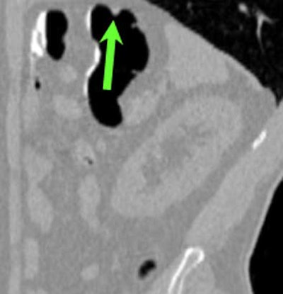 2004 11 22 16 14 18 706