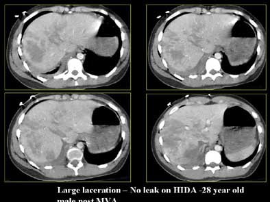 2004 11 29 17 49 45 706