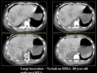 2004 11 29 17 49 45 706