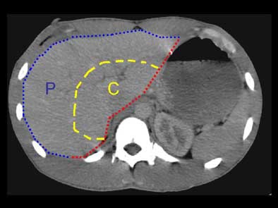 2004 11 29 17 50 01 706