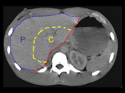 2004 11 29 17 50 01 706