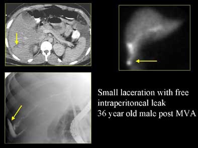 2004 11 29 17 50 20 706