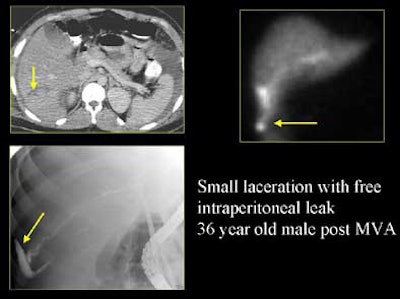 2004 11 29 17 50 20 706