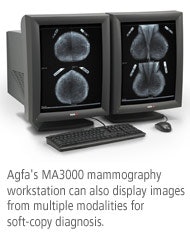 Agfa