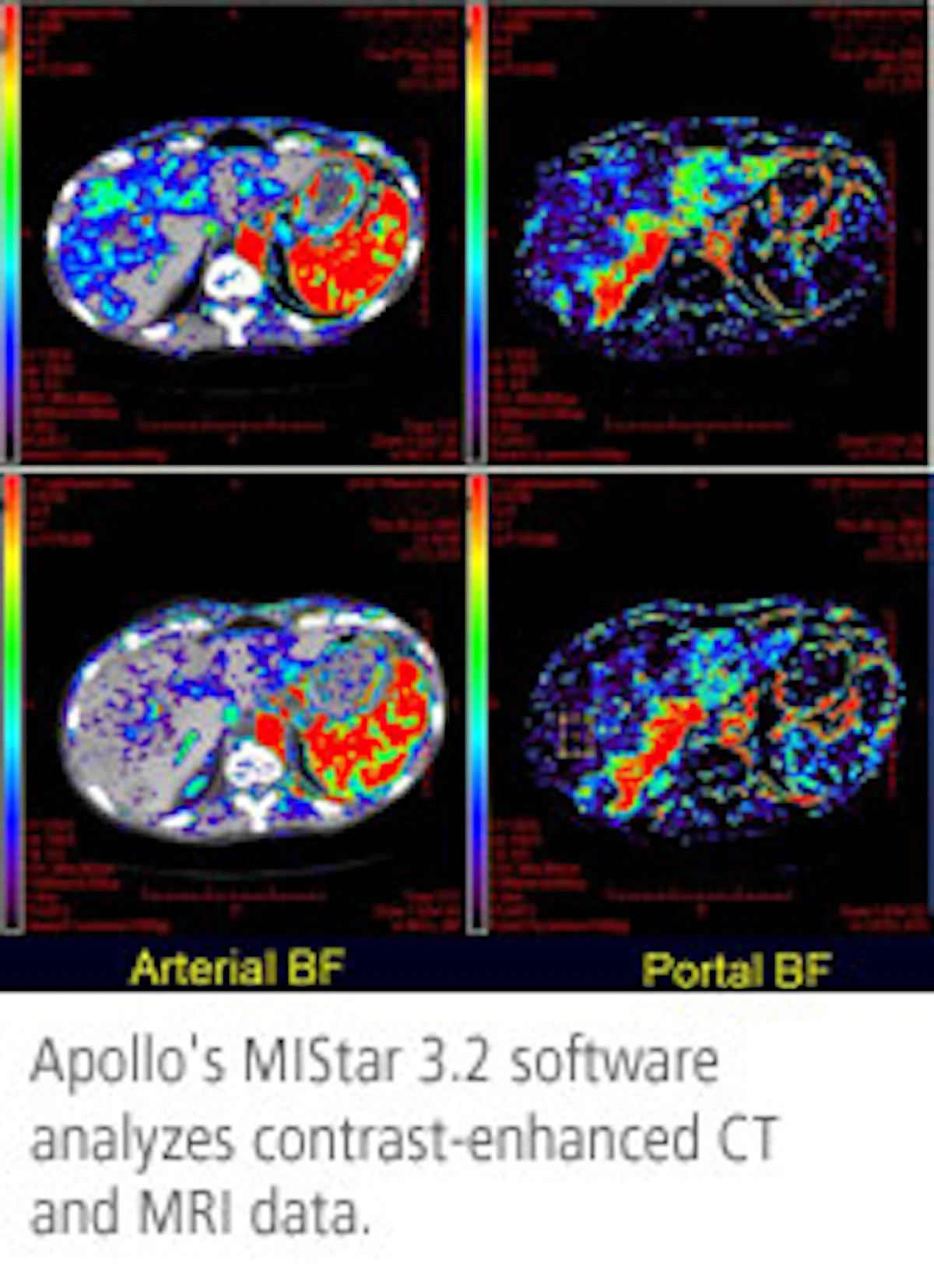 Apollo Medical Imaging Technology | AuntMinnie