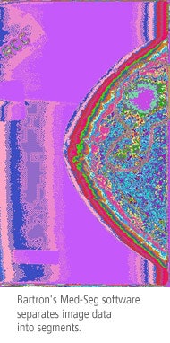 Bartron