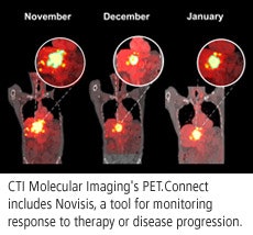 Cti
