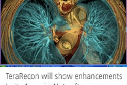 Terarecon