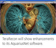 Terarecon