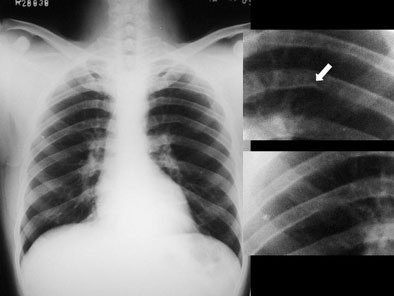 2004 11 30 19 08 04 706