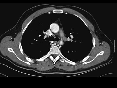 2004 11 30 19 08 22 706