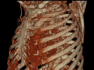 2004 11 30 19 08 54 706