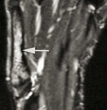 2004 12 07 17 04 33 706