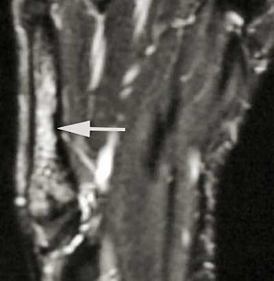 2004 12 07 17 04 33 706