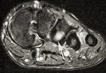 2004 12 07 17 04 49 706