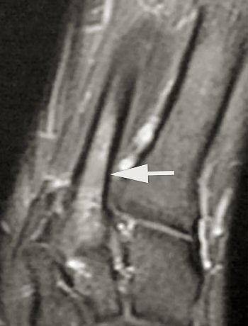 2004 12 07 17 05 08 706