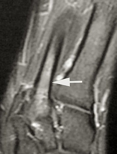 2004 12 07 17 05 08 706