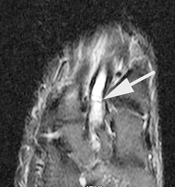 2004 12 07 17 05 26 706