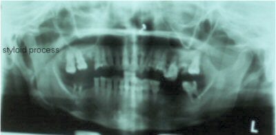 2004 12 08 11 51 30 706