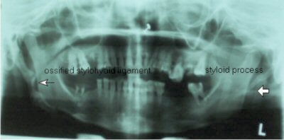 2004 12 08 11 52 01 706