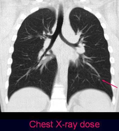 2004 12 10 11 29 44 706