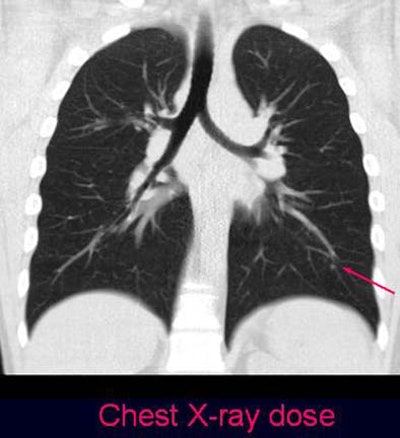 2004 12 10 11 29 44 706